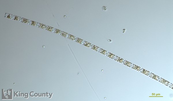 Photo of Cerataulina pelagica
